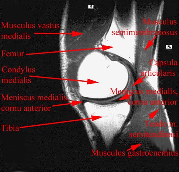 anatomia radiologiczna - 44.jpg